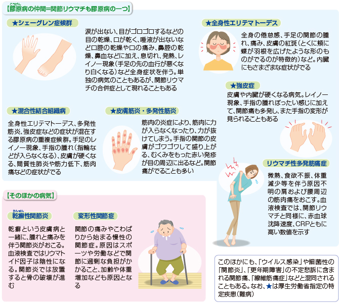 関節 が の 痛い 全身