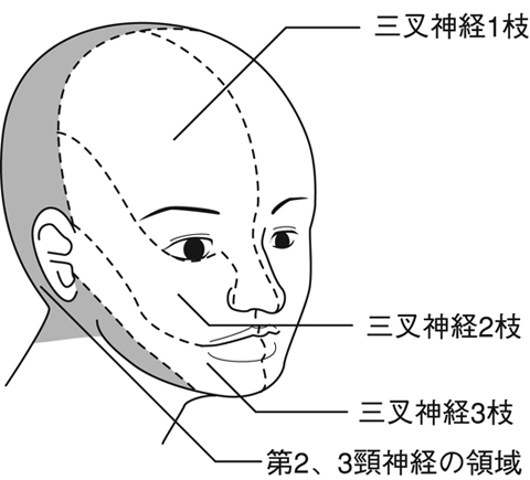 図29　三叉神経各枝の顔面分布領域