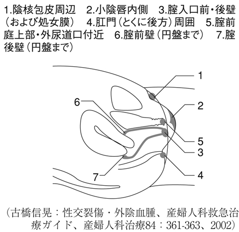 女性性器損傷とは 医療総合qlife