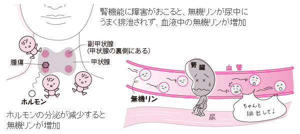 無機リン Ip とは 病気の検査法を調べる 医療総合qlife