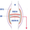 関節リウマチとはどんな病気か 前編