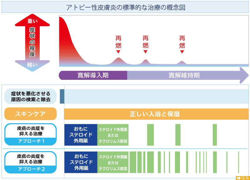 アトピー性皮膚炎の標準的な治療の概念図