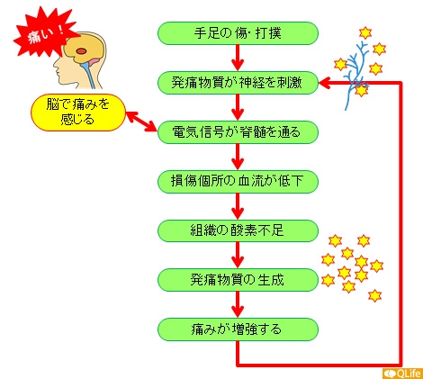 メカニズム 痛み の