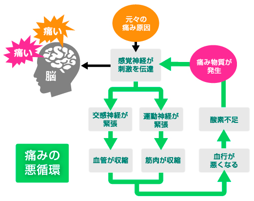 痛みの悪循環